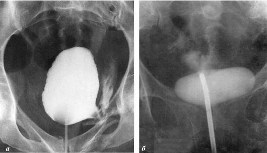 The promising urology specialist told us how she managed to restore potency to her patients aged 60 to 70.